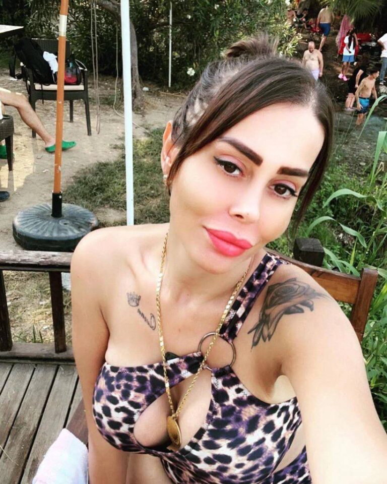 Yağ Aldırma Ameliyatı Faciası: 32 Yaşındaki Kadın Hayatını Kaybetti!