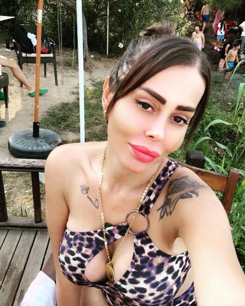 Yağ Aldırma Ameliyatı Faciası: 32 Yaşındaki Kadın Hayatını Kaybetti!